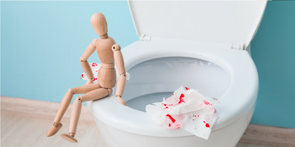 What Causes Blood in Stool?